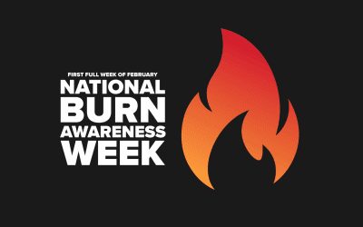 National Burn Awareness Week: How to Prevent Burns on the Jobsite